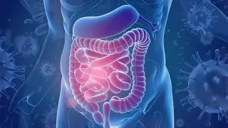 High-Dose Eight-Strain Probiotic Improves Biochemical Markers in Bile Acid Malabsorption