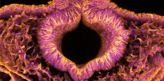Glowing Quail Embryos Reveal How Neural Tubes Form