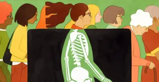 Bone Density in Menopause: Timing Your First DEXA Scan
