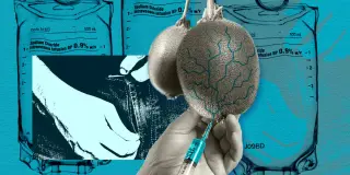 Ballmaxxing: The Fetish of Inflated Testicles and the Hidden Dangers