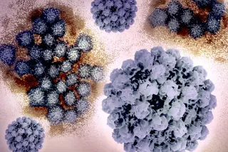 Brooklyn wedding tainted by norovirus sparks hotel-catering lawsuit