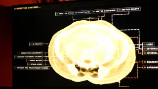 Midjourney Tries Spa-Style Full-Body Ultrasound to Rival MRI