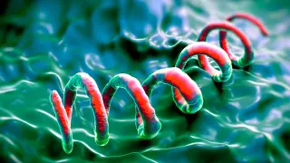 Itchy rash uncovers rare syphilis with neurosyphilis in an elderly man
