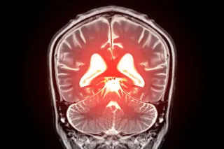 Gatekeeper KLF4 in Brain Vessels Linked to Age-Related Cognitive Decline