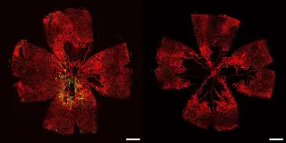 Lab-grown retinal vessels restore function in mice, fueling hope for blindness treatments