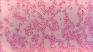 Long Island Reports Three Probable Tularemia Cases as Tick-Borne Illnesses Rise
