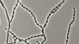 CDC Report Flags Fourfold Surge in Deadly Brain Fungus Cases Since 2023