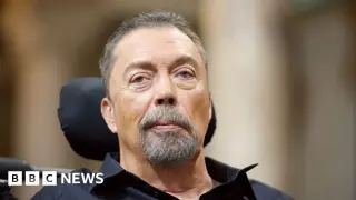 Tim Curry dies at 80; coronary artery disease listed as cause