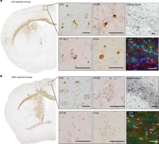 Human Tau Strains Retain Structural Identity in Mouse Brains, Validating Prion-Like Transmission