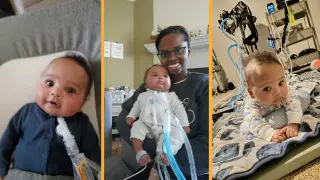 In‑utero rescue: doctors drain a fetus's lungs at 25 weeks and return him to the womb