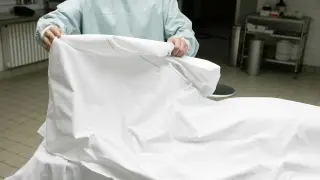 Cadaver reveals rare triphallia case: three penises in one donor