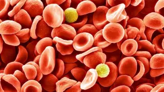 Stress in Minutes: Acute Anxiety Reconfigures Blood Clots