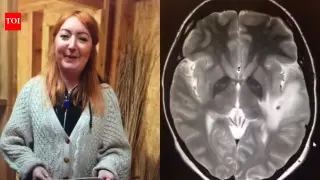 Backpacking trip to India leaves UK woman with 38 brain parasites, now turning ordeal into a podcast