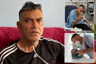 California Faces Sharp Rise in Silicosis Linked to Quartz Countertops, Study Finds