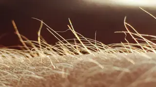 Hair-trigger itch: mice reveal vellus hairs as a mechanical itch sensor