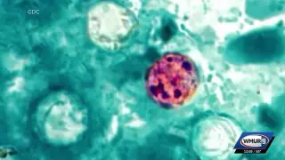 NH sees cyclosporiasis rise as recalled-product cases expand