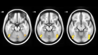 Training Rewires the Brain for Real Multitasking