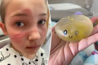 Water-bead squishy toys recalled over serious injury risk, refunds offered
