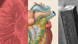 LDL Unpacked: Simple Steps to Lower Bad Cholesterol and Cut Heart Risk