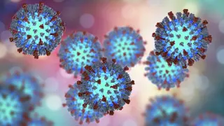 Manhattan measles case prompts exposure alert for Hell's Kitchen diners
