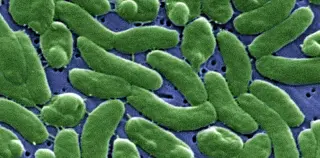 Warmer Seas Expand Flesh‑Eating Bacteria—How to Stay Safe