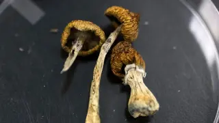 High-Dose Psilocybin Sparks Temporary Functional Gains in Alzheimer's Case