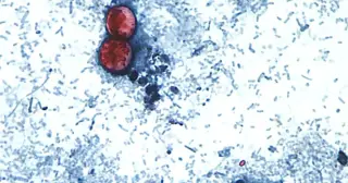 Lettuce-Linked Cyclospora Outbreak Hits Taco Bell Across Five Midwest States