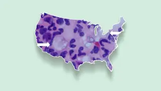 CDC map highlights Texas and Delaware as top U.S. Naegleria fowleri infections