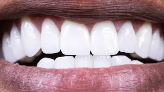 Food that nourishes your mouth's good bacteria