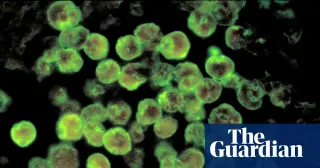 North Carolina teen Moises Ponce Mendoza dies of rare Naegleria fowleri infection