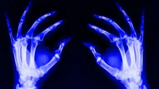 Aging Blood Stem Cells May Spark Inflammation Across the Body