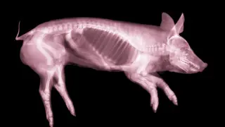 Shinbone Compression Triggers Brain Repair via Blood-Borne Signals