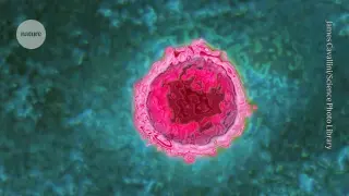 Severe COVID-19 May Trigger Dormant Viruses, Tied to Long COVID