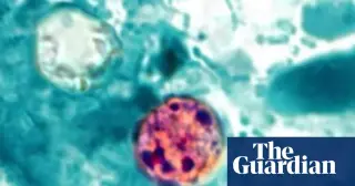 Two deaths in Michigan mark grim turn in U.S. cyclosporiasis lettuce outbreak