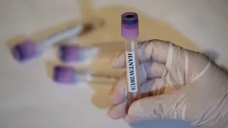 CDC: No current U.S. hantavirus cases, 41 people under monitoring amid cruise-ship outbreak