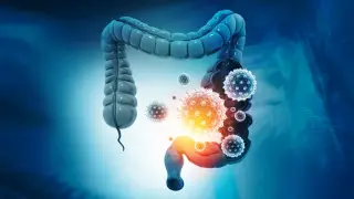 AI-Driven Stool Test Detects 90% of Colorectal Cancers, Offering Non-Invasive Screening