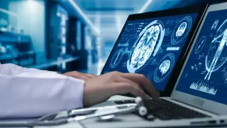 Early-Onset Dementia Study Identifies Persistent Risk Factor