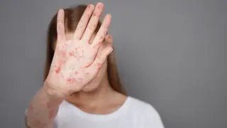 Pennsylvania Sees Third Measles Death as Outbreak Expands