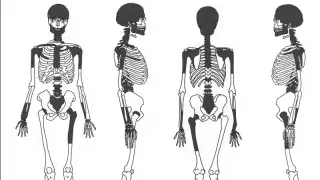 Brain-removal ritual linked to Iron Age Scottish burial, study finds