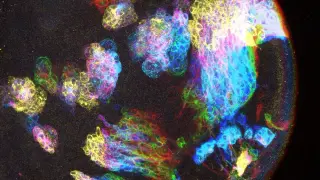 Developmental State May Explain Why Brain Regions Are More Cancer-Prone