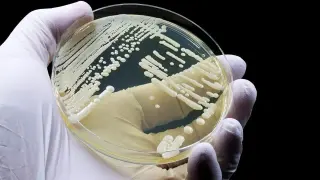 Fungus 'superbug' Candida auris spreads to 23 states, including Wisconsin