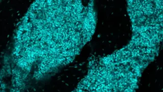 Hidden Skull Immune Hubs May Help Fight Brain Cancer