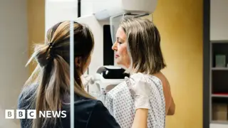 Young women slipping through screening gaps prompts call for broader risk tools