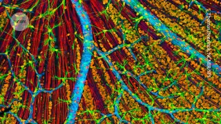 First patient treated in trial turning back cellular age to tackle glaucoma