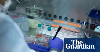 US Sickle Cell Patients Face Severe Access Gap for Red Blood Cell Exchange Therapy