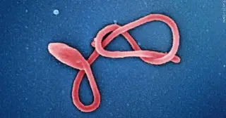 Milwaukee Health Dept Monitors 3 for Ebola; risk deemed very low
