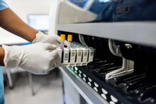 Outdated Genetic Tests May Leave Thousands of Women Unaware of Cancer Risks