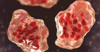 Minnesota Measles Cases Rise as Todd and Fillmore Counties Report New Infections