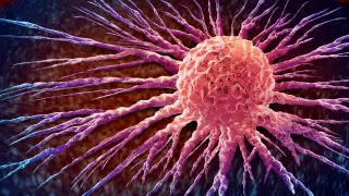 Drug Triggers Tumor Dissolution in Some Cancer Patients, Early Trial Shows