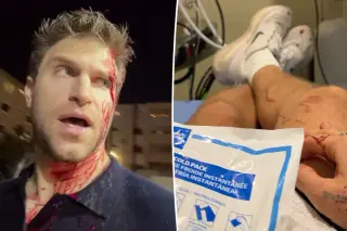 Keegan Allen shares recovery update after violent West Hollywood armed robbery